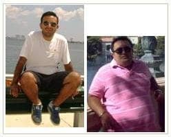 Slider image (5) Antiobesity Center